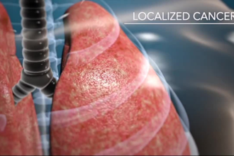create 3d medical animation video, 3d surgery animation, 3d anatomy animation