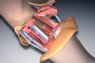 do detailed 3d surgery animation 3d orthopedic animation 3d medical animation