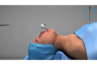 3d medical product explainer animation video surgery animate anatomy scientific