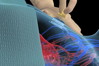do a premium 3d medical animation, 3d animation surgery explainer