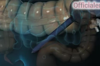 create stunning 3d medical animation and visualization