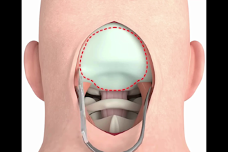 do 3d medical animation surgery animation anatomy biomedical explainer videos
