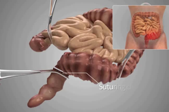 create 3d medical animation, 3d explainer bodies video animation, 3d animation