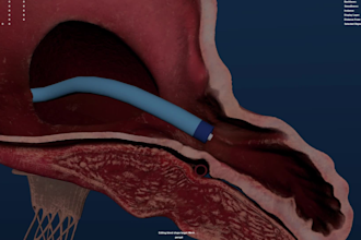 create 3d medical animation for medical procedure medical device medical product