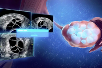 create full HD 3d medical animation surgery anatomy biology medical in blender