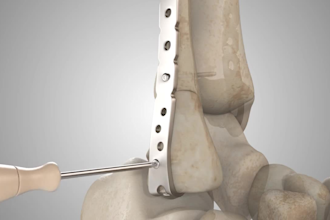 4k 3d medical animation, 3d product demo surgery, 3d vfx,  3d medical industrial