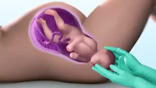 create realistic 3d medical, surgical, and device animation videos, product cgi