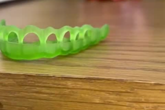 design implant supported crown nightguard gingival splint in exocad