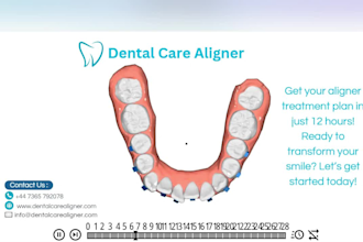 provide expert aligner treatment planning services