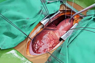 3d surgical animation medical 3d animation surgery animation procedure anatomy
