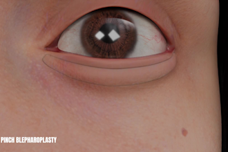 create high quality 3d facial surgery animation video