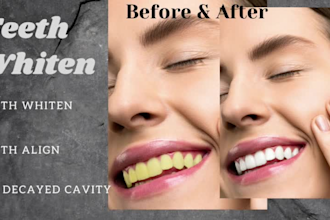fix, adjust, whiten teeth in photoshop within 24 hours