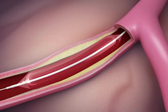 do human anatomy using 3d medical animation
