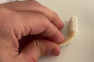 design removable prosthesis in exocad