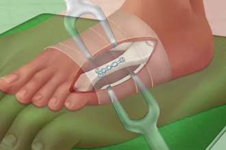 do medical reality video, medical motion graphic,360 3d video, medical character