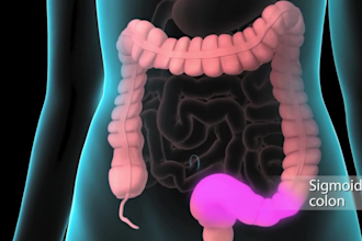 do 3d medical animation, 3d surgery animation, medical explainer medical product