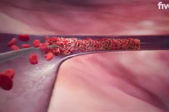 animated 3d medical video,3d product explainer,3d anatomy video, product render