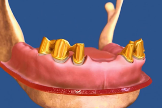 do animation videos for the dental waiting room
