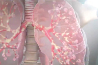3d product animation video 3d medical animation video 3d medical anatomy surgery