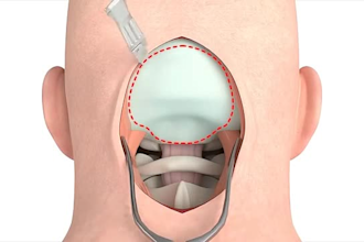 do 3d medical animation, 3d surgery, 3d health anatomy scientific medical device