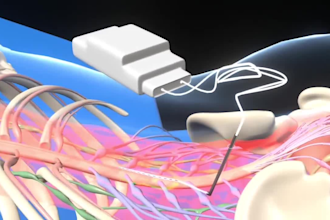 do 3d medical animation 3d surgery animation medical device scientific animation