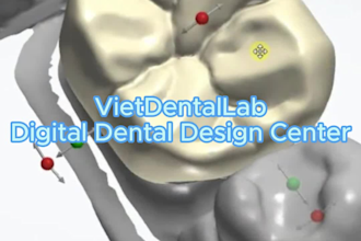 3shape exocad crown and bridge so cheap