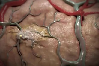 create professional 3d medical animation, surgery animation scientific animation