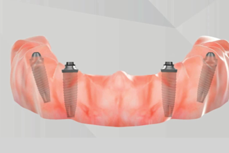 we produce high quality 3d medical animations that simplify complex concepts