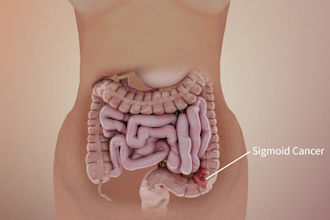 create realistic 3d medical and surgical animation for healthcare project