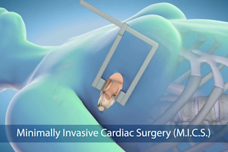 3d medical product animation 3d medical explainer videos anatomy surgery videos