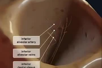 3d surgery animation,healthcare product,biomedical illustration anatomy science