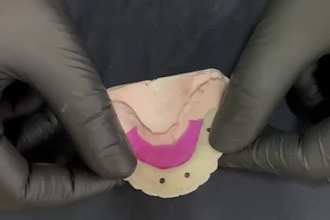 design dental crowns, bridges, implants in cad