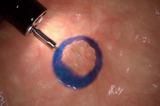 create 3d medical animation 4k, cgi surgery process and anatomy visualization