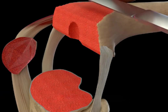do 3d medical animation video, 3d dental animation, 3d surgery animation video