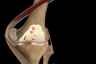 create 3d medical animation, 3d industrial product animation, surgery animation
