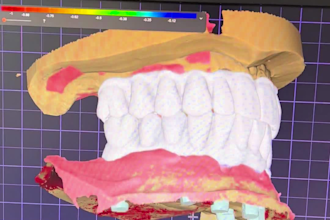 create dental artistry with exocad 3d