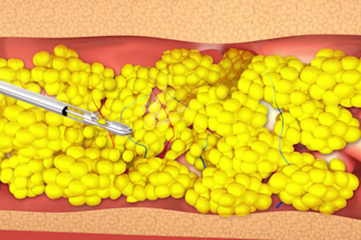 offer custom 3d medical animation, 3d surgery, 3d eye animation, 3d breast feed