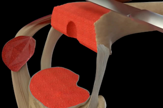 create 3d medical animations, 3d medical animation video 3d surgical animation