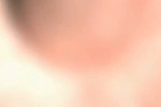 3d medical and biomedical dental animation, surgery explainer video