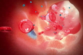 3d medical animation video, 3d surgery procedure, 3d animation video, 3d medical