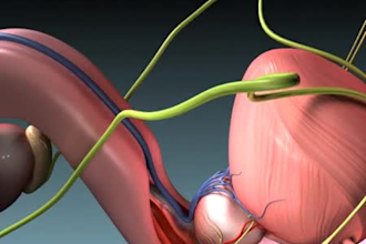 create 3d medical animation surgical procedure anatomy explainer product renderi