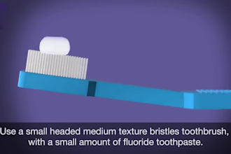 do realistic 3d dental animation 3d medical animation 3d toothbrush video