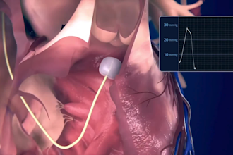 do 3d medical animation 3d medical device explainer medical animation