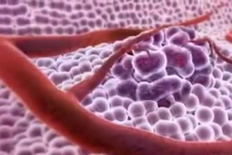 create high end 3d medical animation, 3d 2d whiteboard medical explainer video