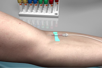 create realistic 3d surgical animation for medical explainer videos