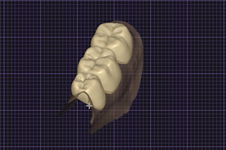 design provisional crowns, bopt eggshells etc