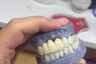 design high quality crown in exocad