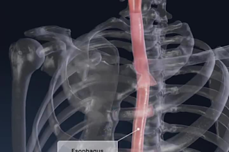 do medical animation 3d surgery animation 3d medical device explainer anatomy