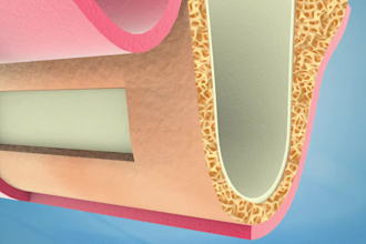 create high quality 3d dental animation 3d medical animation 3d medical device