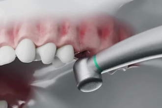 do 3d medical animation for 3d dental animation medical device electric gadget